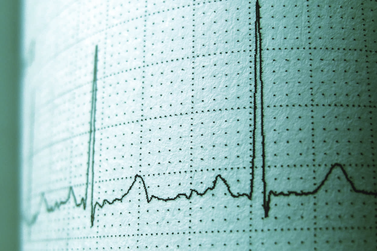 A heart monitor showing lines going up and down sporadically – Viome Oral Health Intelligence Test